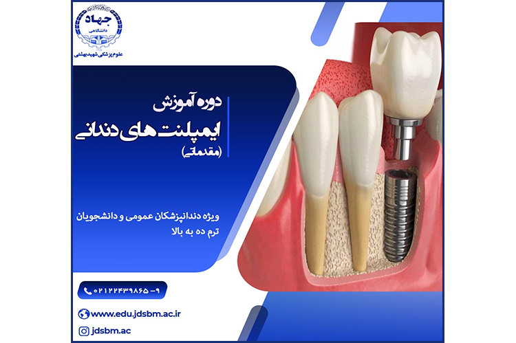 دوره آموزشی جامع ایمپلنت های دندانی در جهاددانشگاهی علوم پزشکی شهید بهشتی برگزار می شود