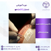 دوره آموزشی دستیار کاشت مو در جهاددانشگاهی علوم پزشکی شهید بهشتی برگزار می شود